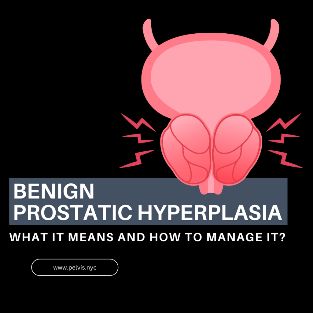 Benign Prostatic Hyperplasia (BPH): What It Means and How to Manage It